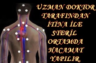 İTİNA İLE STERİL OLARAK HACAMAT YAPILIR.